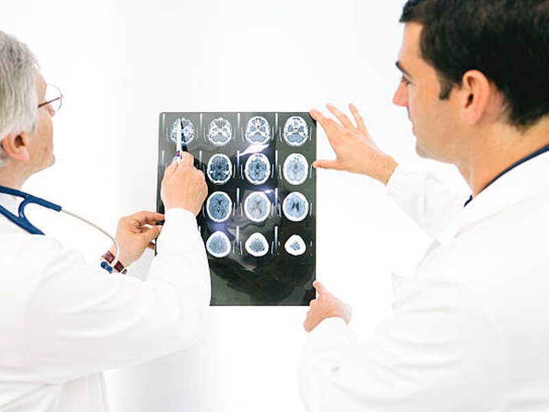 Memory and Neuro Health at Health Nourish Base